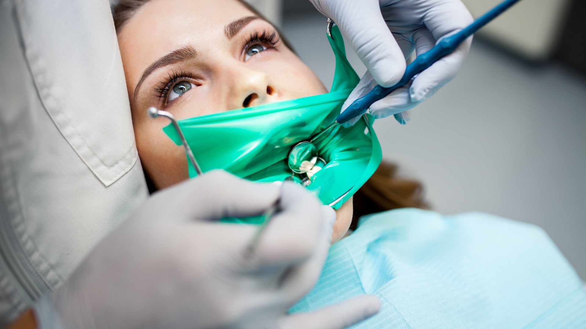 האם חייבים לעקור שן בינה כלואה